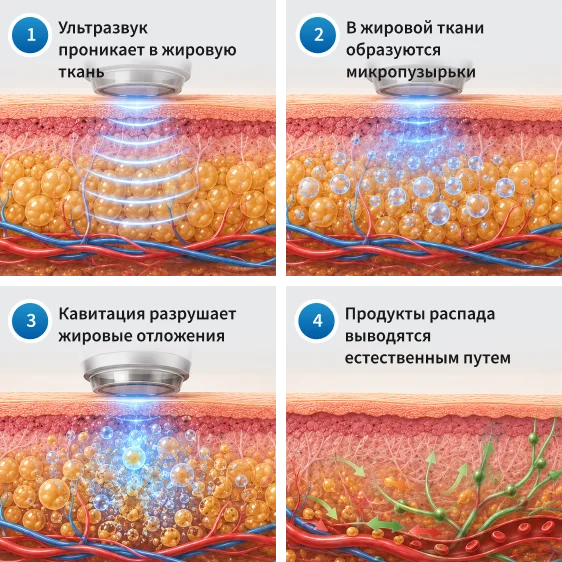 Как работает ультразвуковая кавитация?