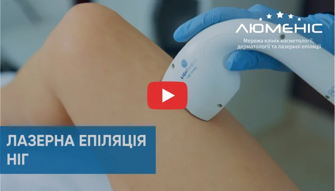 Дивіться відео як проходить процедура лазерної епіляції ніг