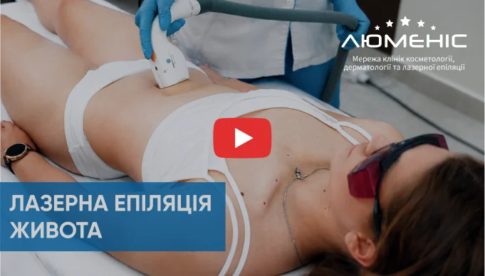 Дивіться відео як проходить процедура лазерної епіляції живота