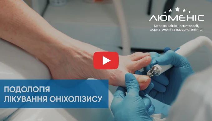 Как проходит лечение онихолизиса