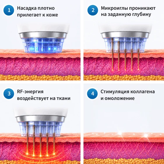Как работает микроигольчатый rf лифтинг?