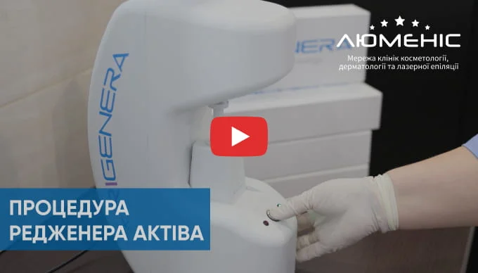 Дивіться відео як проходить як проходить процедура Regenera Activa