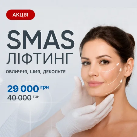 SMAS Ліфтинг